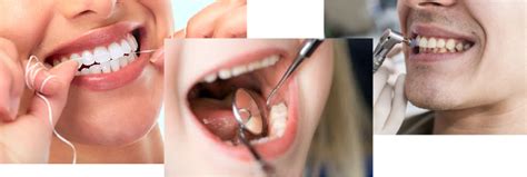 Oral Hygiene - Cape Dental Care