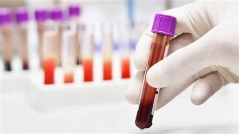 Blood Test Detects And Classifies Cancer At Its Earliest Stages