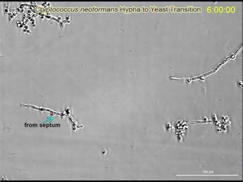 Life Cycle Of Cryptococcus Neoformans Supplemental Video YouTube