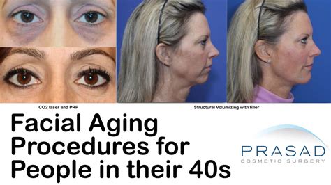 Facelift Surgery And Eyelid Surgery By Dr Amiya Prasad New York