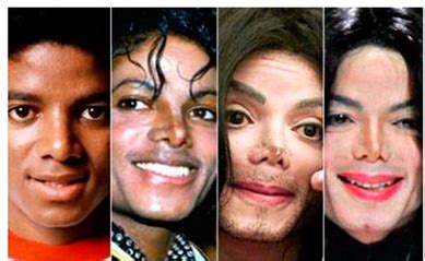 La Nariz De Michael Jackson