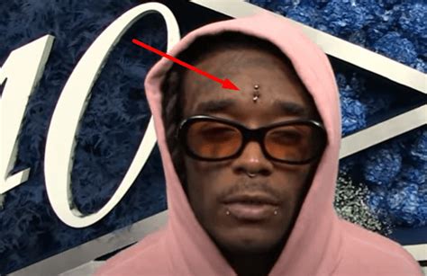 Lil Uzi Vert Claims Pink Forehead Diamond Was Ripped Out By Fans