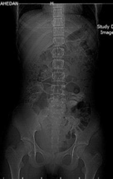 Abdominopelvic Ct Scan Download Scientific Diagram