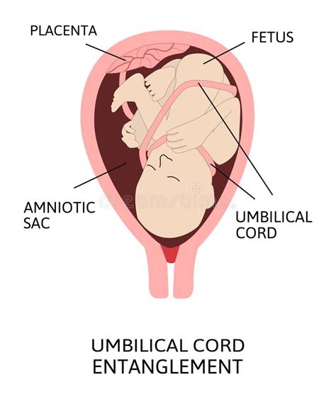 It acts as the baby's lungs by providing oxygen from the mother, as its kidneys by filtering the study found that at delivery, the concentration of placental exosomes correlated with the weight of the placenta. Placenta And Umbilical Cord Of Newly Born Baby. Organ Attached To The Lining Of Womb During ...