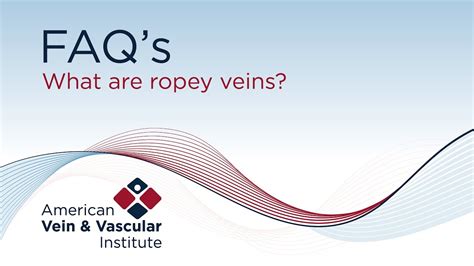 What Are Ropey Veins American Vein And Vascular Institute Youtube