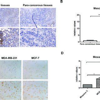 Mesothelin Expression In Carcinoma Tissues And Cell Lines Of Breast