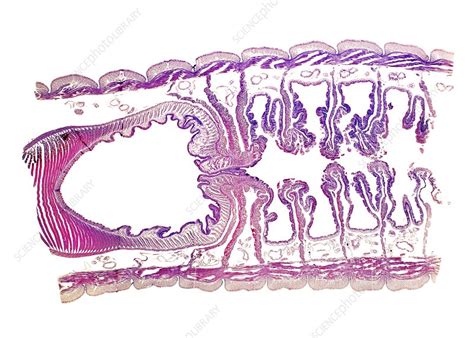 Earthworm Light Micrograph Stock Image C0210446 Science Photo