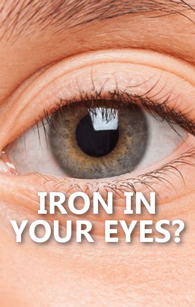 Dr Oz Iron Deficiency Eye Test And Unexpected Spring Allergy Triggers