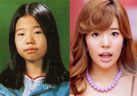 Snsd Sunny Plastic Surgery Before And After