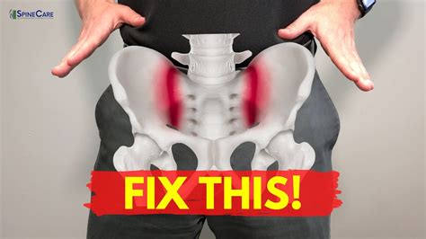 How To Fix Sacroiliac Joint Pain For Good Youtube