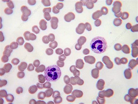 Leucocytes Lm Stock Image C0435155 Science Photo Library