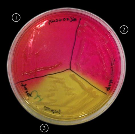 Microbiology Lab Report On Escherichia Coli And Staphylococcus Aureus
