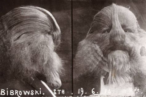 Stephan Bibrowski A Polish Man Born With Hypertrichosis In 1890 He