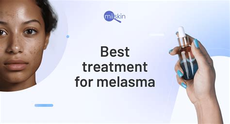 Dermatologist Endorsed Treatments For Melasma On The Face