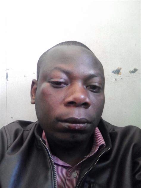 Newsday Journalist Assaulted While On Duty Misa Zimbabwe