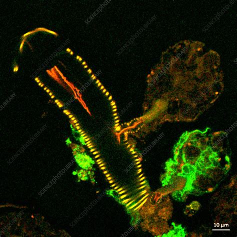 Infected Tick Salivary Gland Light Micrograph Stock Image C050