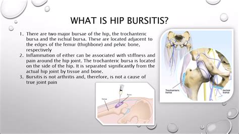 The Best Treatment Hip Bursitis In Ipoh Youtube