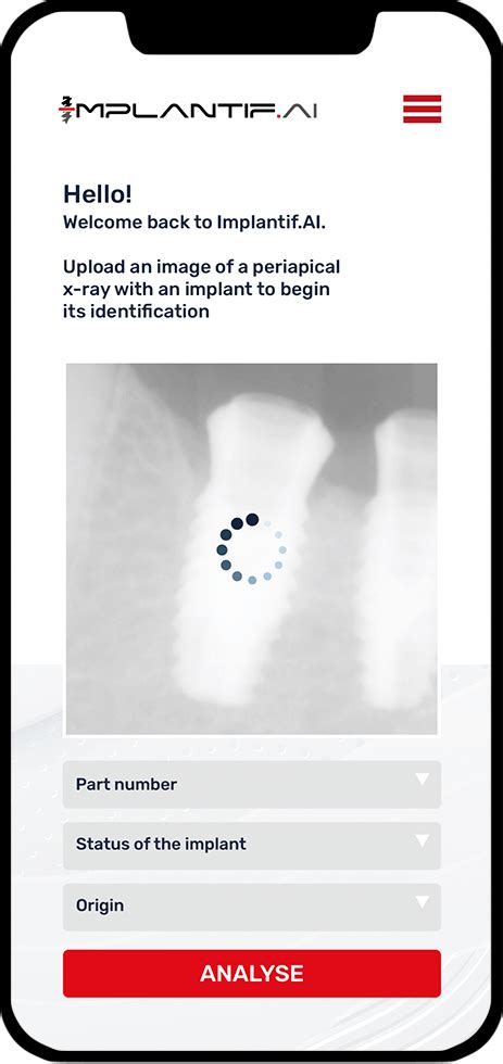 Implantifai Your Dental Implant Identification Assistant