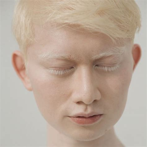 17 Fotografias fantásticas mostram como são os albinos ao redor do mundo