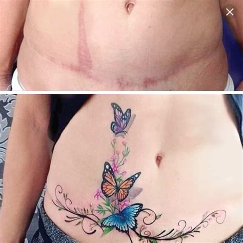 Transforming Scars Into Art Impressive Cover Up Tattoos Congnghedaiviet Info