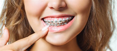 Surprising Benefits Of Orthodontic Treatment Pickme Easy