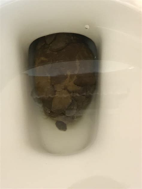 Clogged Toilet With Poop