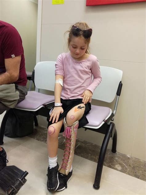 Girl Who Faced Having Her Leg Amputated Has Pioneering Op To Lengthen Her Leg