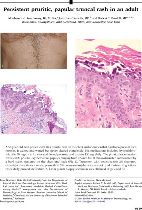 Persistent Pruritic Papular Truncal Rash In An Adult Journal Of The