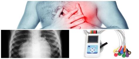 Miocardiopatia Hipertrofica Qué Es Síntomas Causas Diagnóstico y