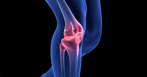 How Obesity Can Result In Knee Pain And Rheumatoid Arthritis Olde Del Mar