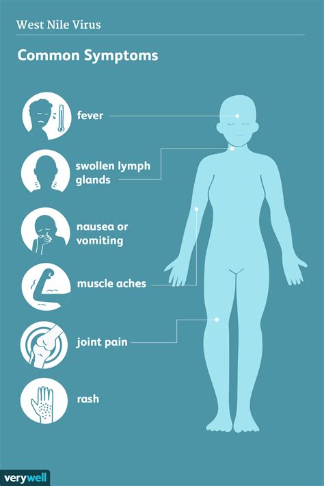 West Nile Virus Signs Symptoms And Complications