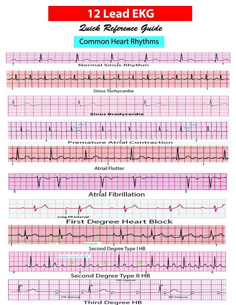 Reading The Heart Ekg Practice Worksheets For Nurses And Medical