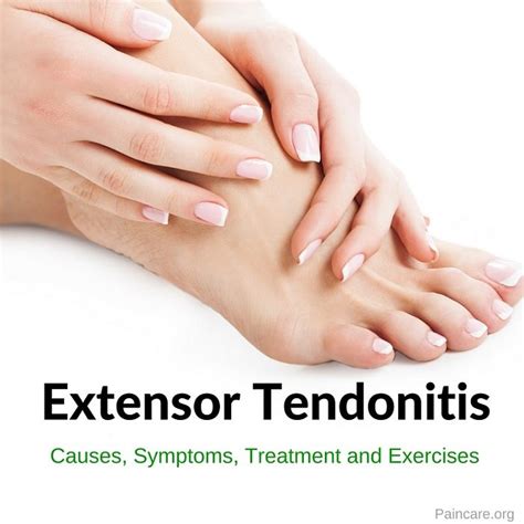 Extensor tendons are tendons in your hands and feet that play an important role in their movements. Extensor Tendonitis - Causes, Symptoms, Treatment ...