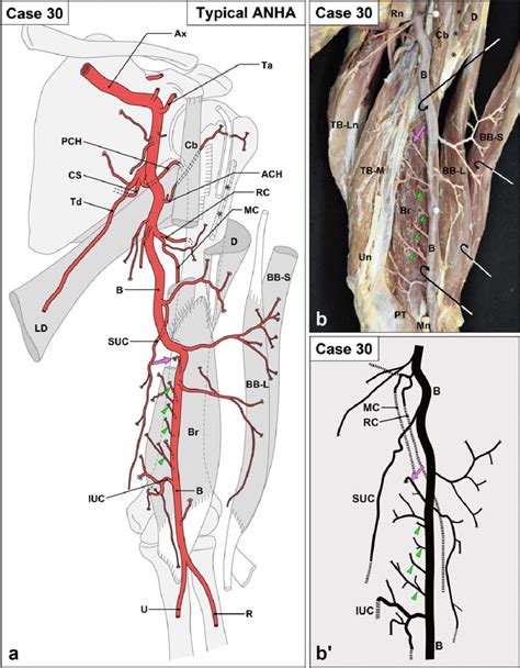 Arteries Diagram Upper Body This Diagrams Shows The Major Arteries In