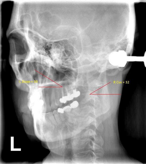 How Is Upper Cervical Different Upper Cervical Chiropractic San Diego