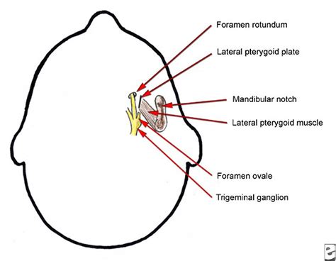 Trigeminal Ganglion Location