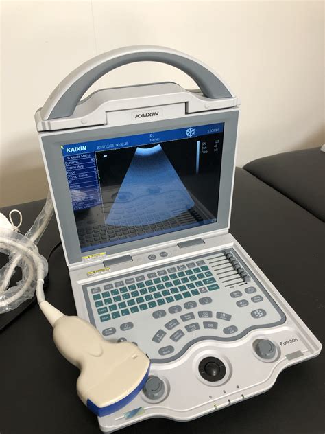 Like New Kx5600v Scanner Portable Ultrasound Machines