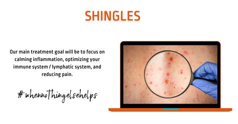 Can Anf Therapy®️ Help With Issues Related To Shingles Anf Therapy