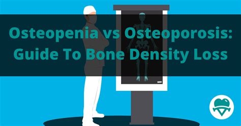 Osteopenia Vs Osteoporosis A Guide To Bone Density Loss
