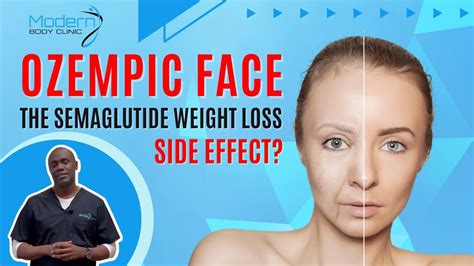 The Ozempic Face Side Effect Does Semaglutide Make You Look Older
