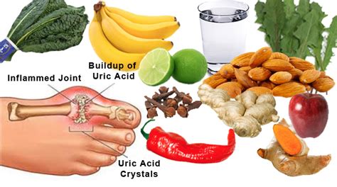 If you have gout, you don't have to avoid all fruit. How To Eat Your Way Out Of Uric Acid Build Up And Get Rid ...