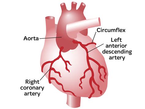 Coronary Artery Disease CAD Ischaemic Heart Disease Heart Foundation