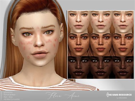 The Sims Resource Flora Acne