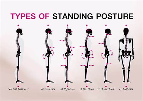 A Guide To Good Posture Macclesfield Strength And Conditioning