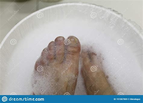 Neglected Feet And Pedicure Foot Care Stock Image Image Of Feminine