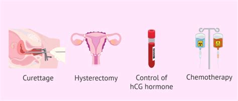Molar Pregnancy Or Hydatidiform Mole Types Symptoms And Diagnosis