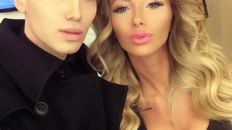 Meet The Real Life Barbie And Ken Who Deny Having Any Plastic Surgery