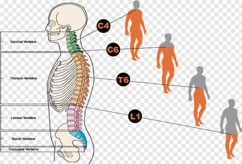 Spinal Cord Diagram Showing Different Types Of Spinal Cord Injuries