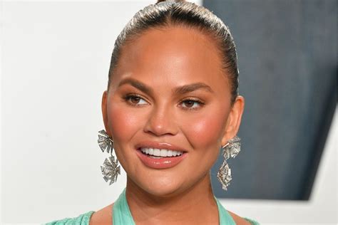 Chrissy Teigen A New Face Thanks To Plastic Surgery