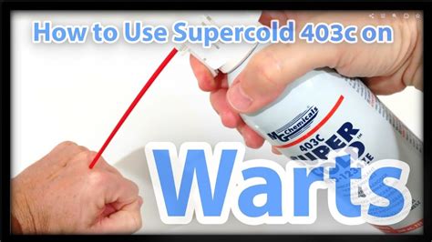 how to use supercold 403c freeze spray on warts skin tags moles or freckles youtube